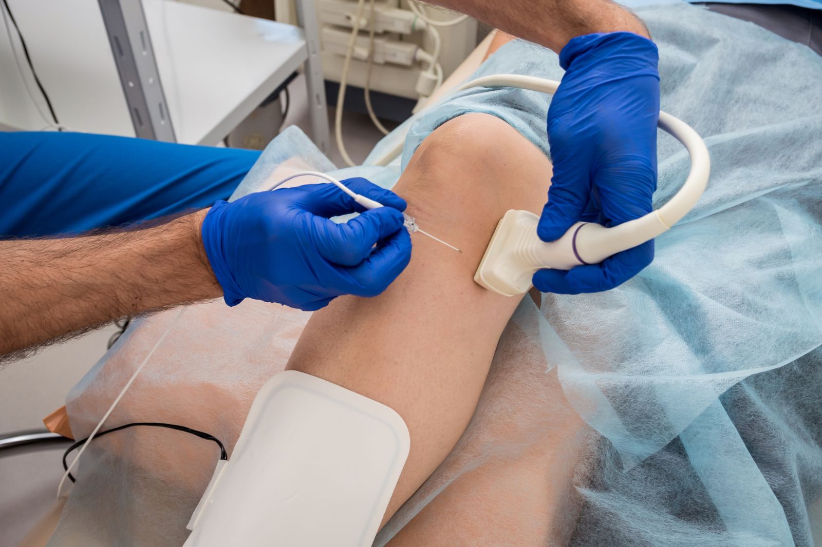 Laser Vein Removal